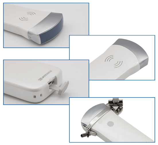 The Portable Convex Ultrasound: Vsono-C2 is a WiFi Convex Ultrasound Scanner. The ultrasound can be connected to your tablet or smartphone, iOS or Android. The dedicated app can be used to view the scans in real-time, store images, or send them by e-mail and manage patients' data. 
