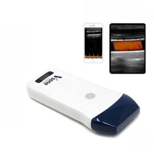 The Wireless Linear Ultrasound Scanner l1